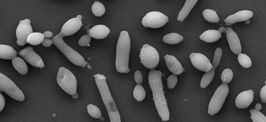 Biofilm de Brettanomyces : une élimination rendue plus difficile