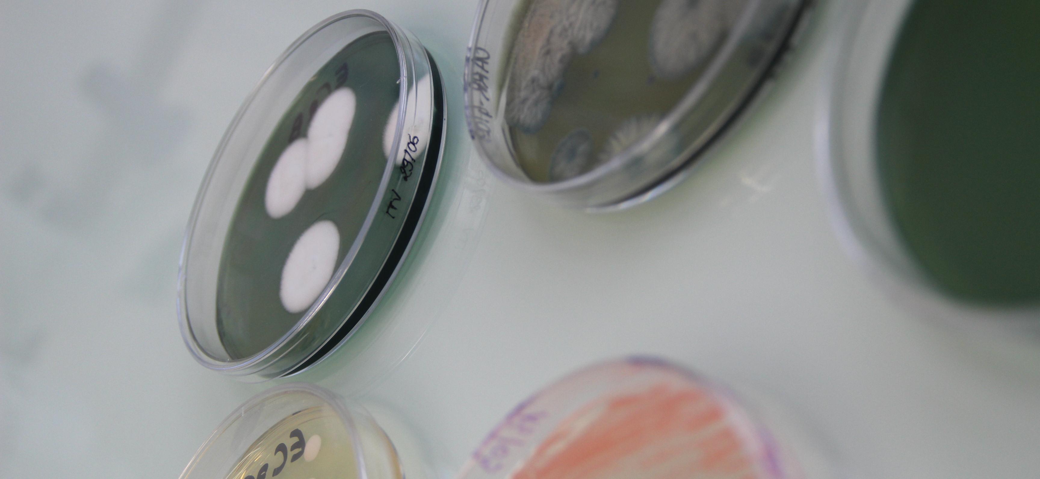 Diversité de la microflore indigène