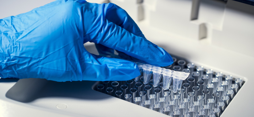 Quand réaliser un contrôle microbiologique ?