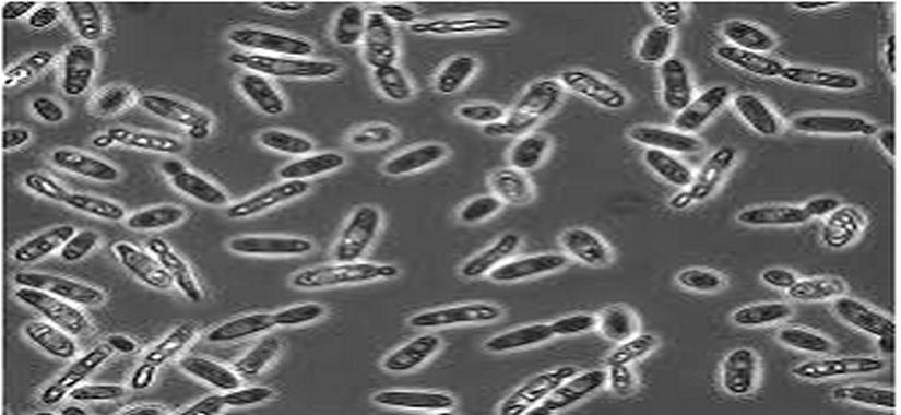 Brettanomyces : lutter contres les biofilms